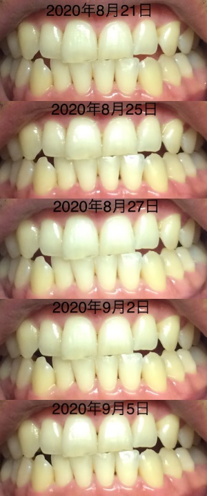 経過写真①