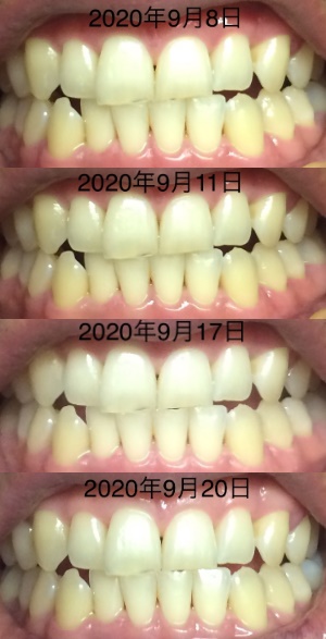 経過写真②